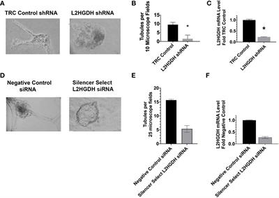 Renal oncometabolite L-2-hydroxyglutarate imposes a block in kidney tubulogenesis: Evidence for an epigenetic basis for the L-2HG-induced impairment of differentiation